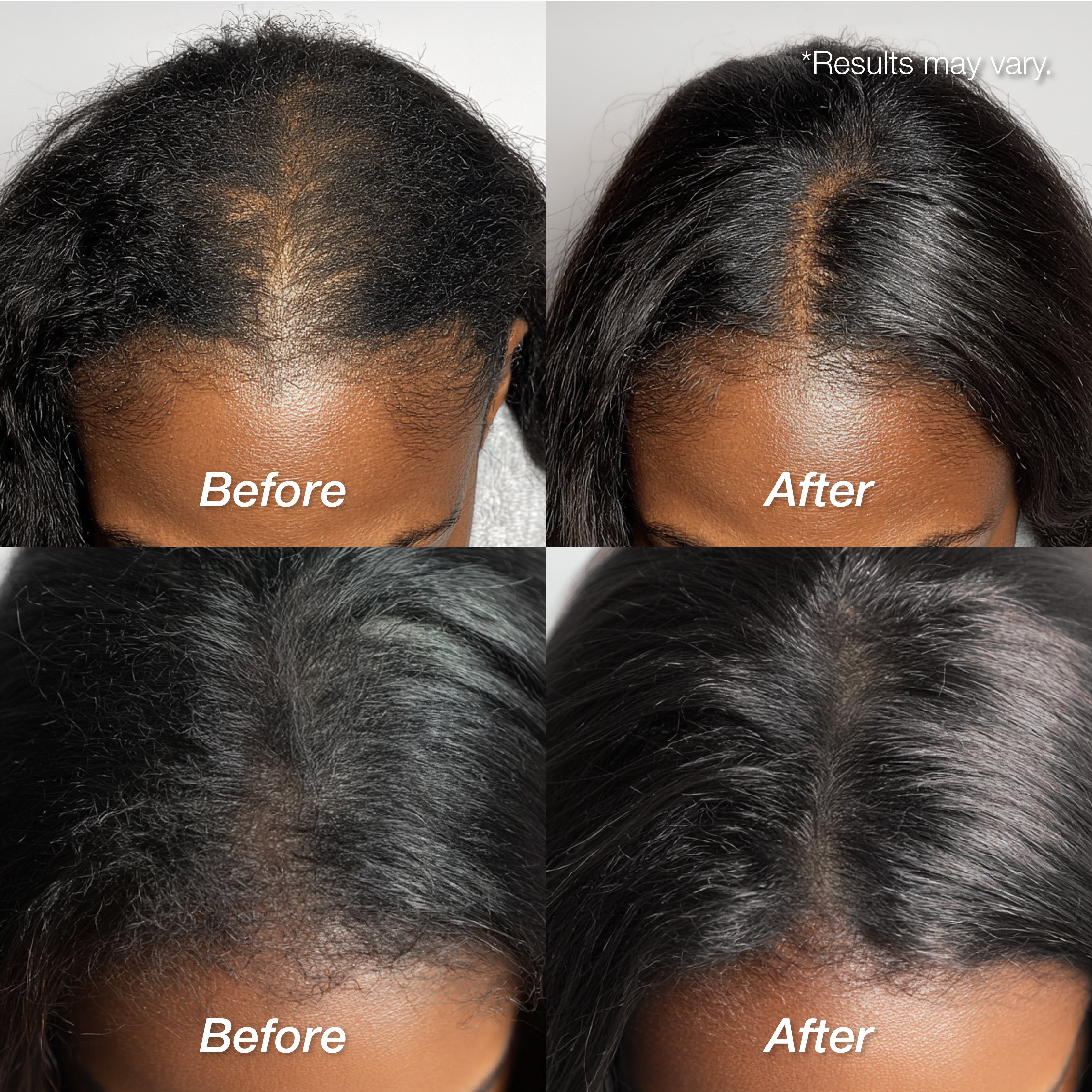 Lux Collection - Scalp Therapy (4 scents)