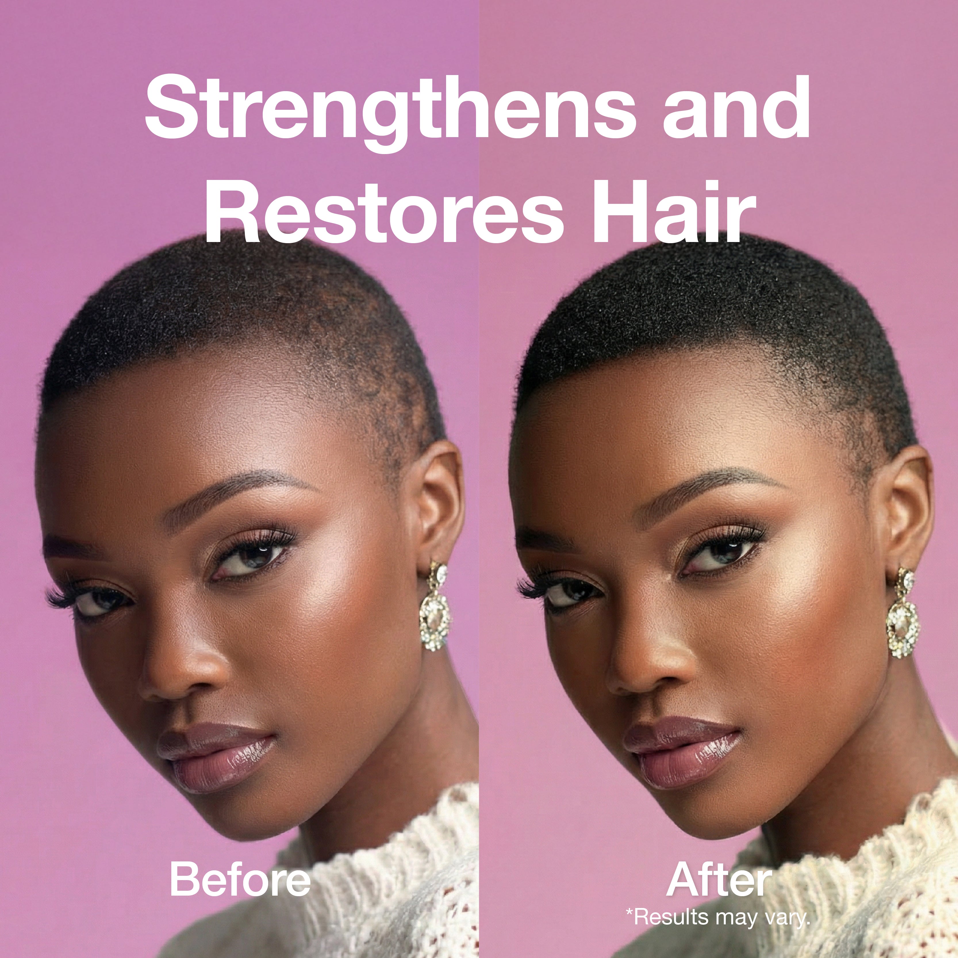 Lux Collection - 3X Miracle Gro Hair Oil | Anti-Itching