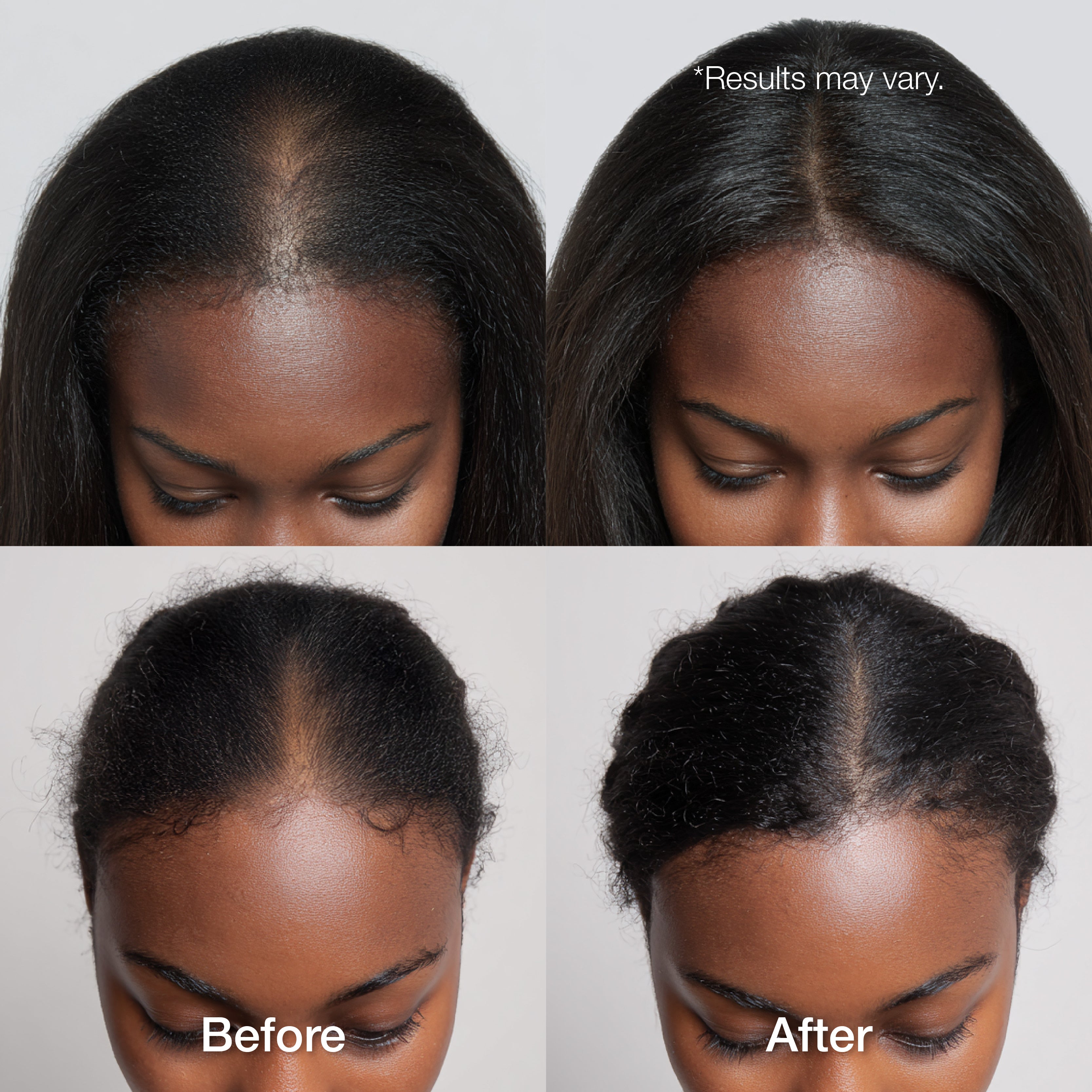 Lux Collection - 3X Miracle Gro Hair Oil | Anti-Itching