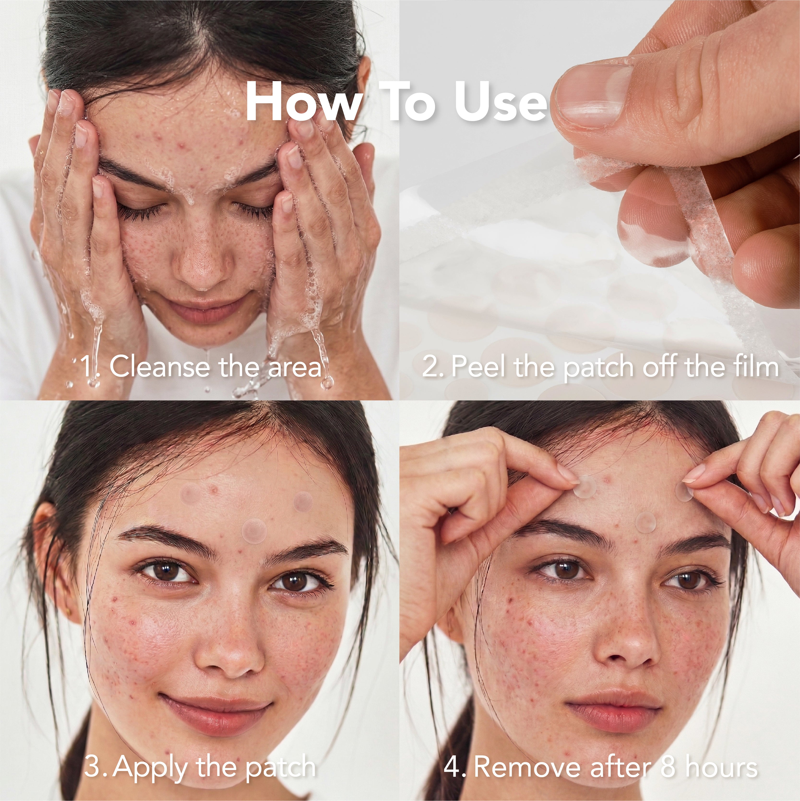 Saplaya - Acne Spot Healing Patch