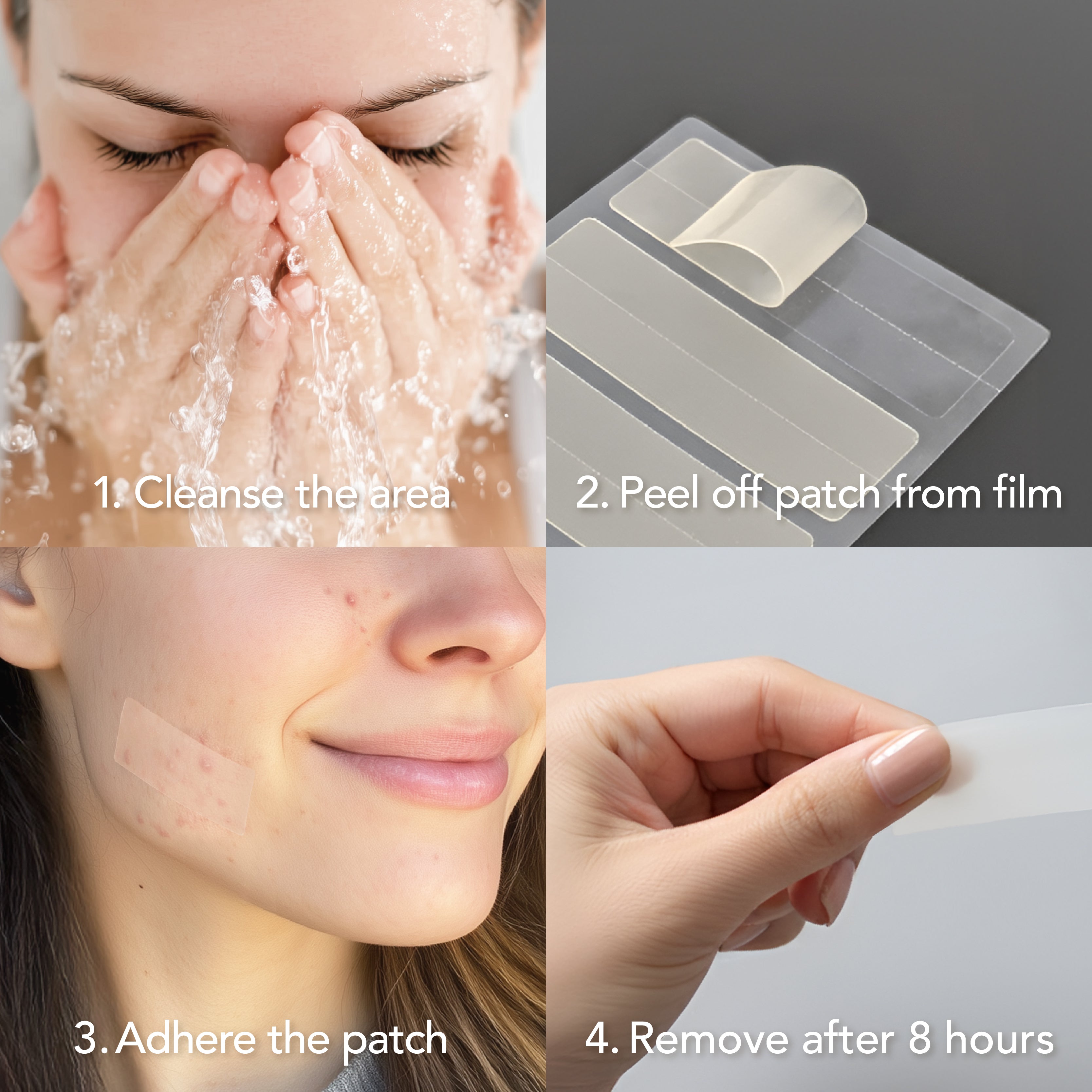 Saplaya - Acne Area Healing Patch