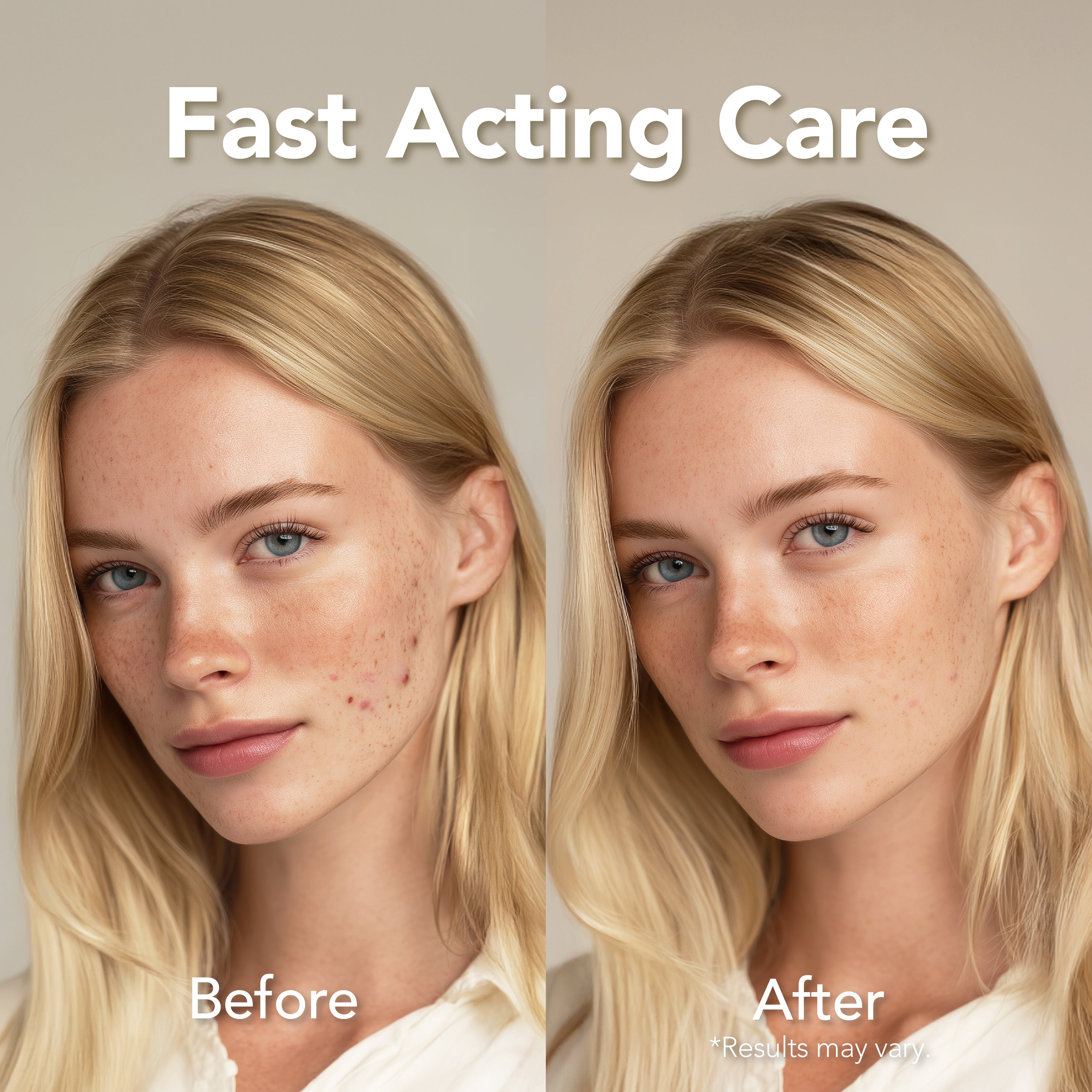 Saplaya - Acne Area Healing Patch