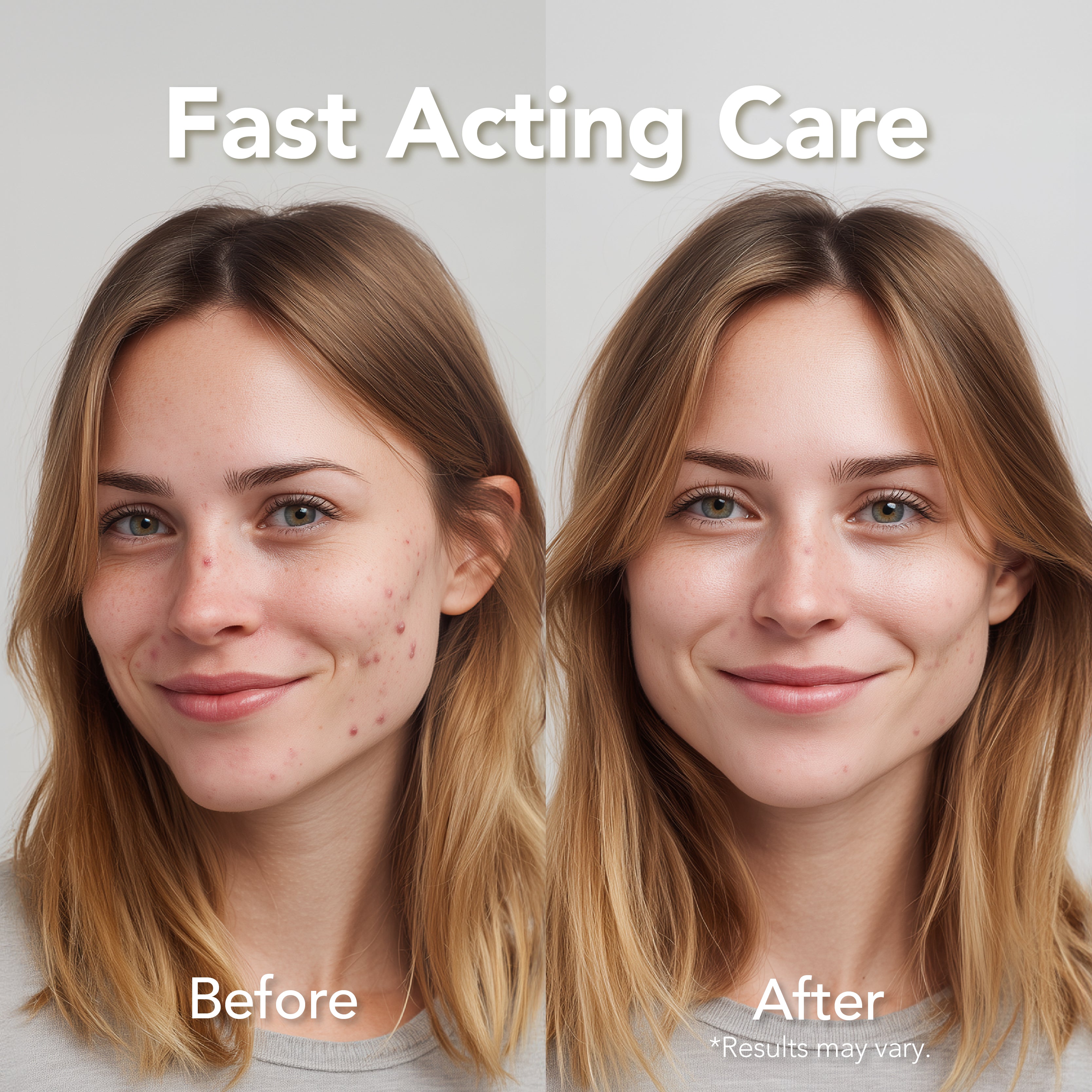 Saplaya - Magnesium Acne Patch